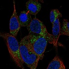 Anti-MRPS21 Antibody