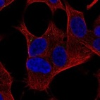 Anti-ZCCHC18 Antibody