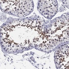 Anti-MLF1 Antibody