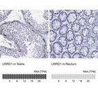 Anti-LRRD1 Antibody