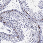 Anti-LRRD1 Antibody