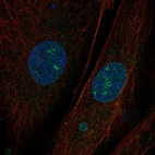 Anti-CEMIP Antibody