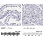 Anti-CCDC70 Antibody