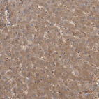 Anti-MICU3 Antibody