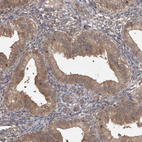 Anti-MICU3 Antibody