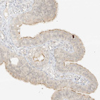 Anti-LIPT1 Antibody