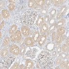 Anti-LIPT1 Antibody