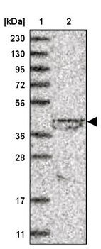 Anti-LIPT1 Antibody