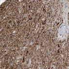 Anti-ZNF189 Antibody