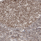 Anti-ARGLU1 Antibody