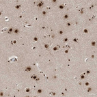 Anti-ARGLU1 Antibody