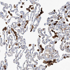 Anti-PEAR1 Antibody