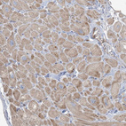 Immunohistochemical staining of human heart muscle shows moderate cytoplasmic positivity in cardiomyocytes.