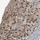 Anti-AZI2 Antibody