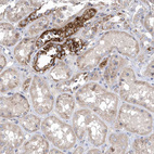 Anti-METTL8 Antibody