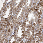 Anti-METTL8 Antibody