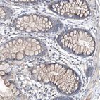 Anti-METTL8 Antibody