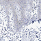 Immunohistochemical staining of human Skin shows no positivity in squamous epithelial cells as expected.