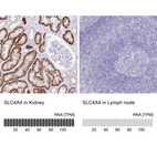 Anti-SLC4A4 Antibody