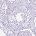 Anti-SLC4A4 Antibody