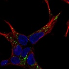 Anti-NELL2 Antibody