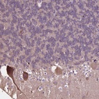 Anti-PCDHA12 Antibody