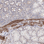 Anti-ZSWIM6 Antibody