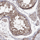 Anti-ZSWIM6 Antibody