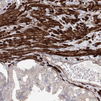 Anti-ZSWIM6 Antibody