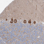 Anti-WDR49 Antibody