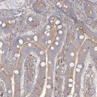 Anti-WDR49 Antibody