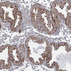 Anti-WDR49 Antibody