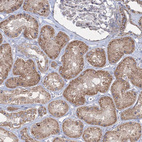 Anti-WDR49 Antibody