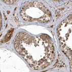 Immunohistochemical staining of human Testis shows moderate granular cytoplasmic positivity in cells in seminiferous ducts and Leydig cells.