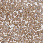 Immunohistochemical staining of human Liver shows moderate granular cytoplasmic positivity in hepatocytes.