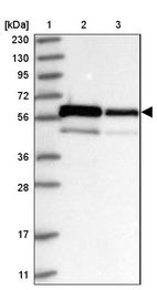 Anti-ZNF622 Antibody