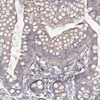 Anti-CIB2 Antibody