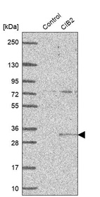 Anti-CIB2 Antibody