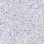 Anti-NKX6-1 Antibody