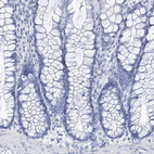 Anti-NKX6-1 Antibody