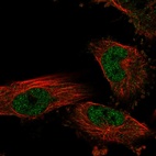 Anti-NKX6-1 Antibody