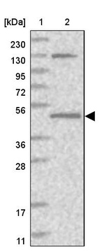 Lane 1: Marker [kDa] 230, 130, 95, 72, 56, 36, 28, 17, 11_br/_Lane 2: Human cell line RT-4