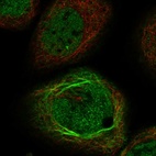 Immunofluorescent staining of human cell line A-431 shows localization to nucleoplasm & intermediate filaments.