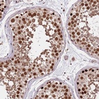 Anti-RIF1 Antibody