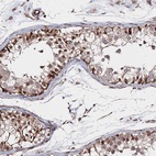 Anti-SNIP1 Antibody