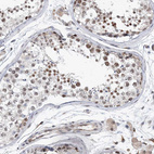 Anti-UIMC1 Antibody