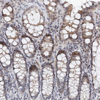 Anti-UIMC1 Antibody