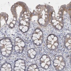 Anti-SEMA3D Antibody