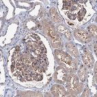 Anti-EPB41L5 Antibody