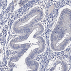 Anti-EPB41L5 Antibody